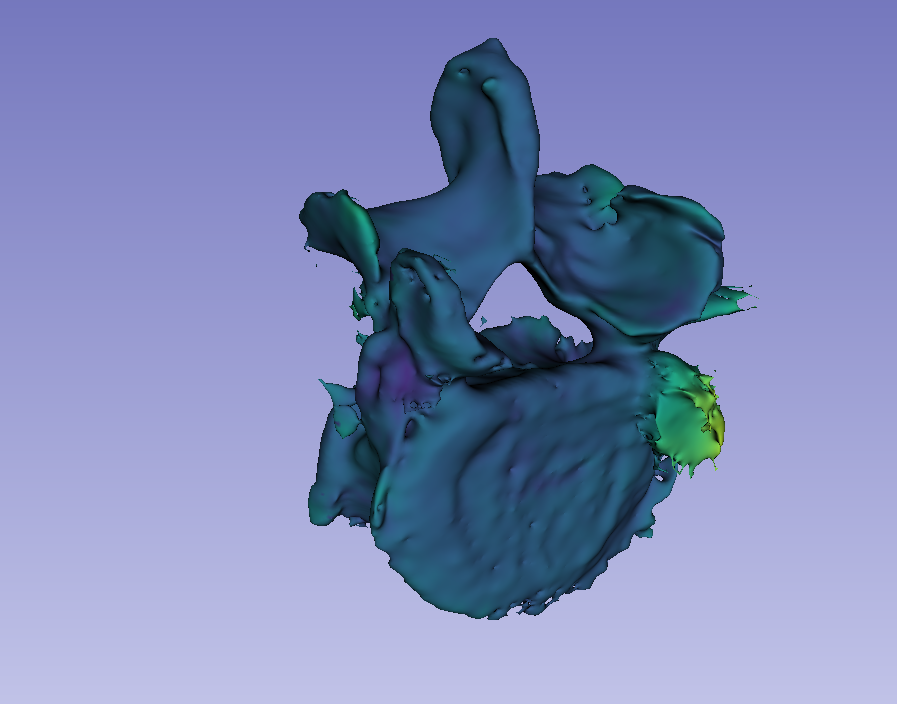 Segmentation on CT and MRI - difference between segmentations